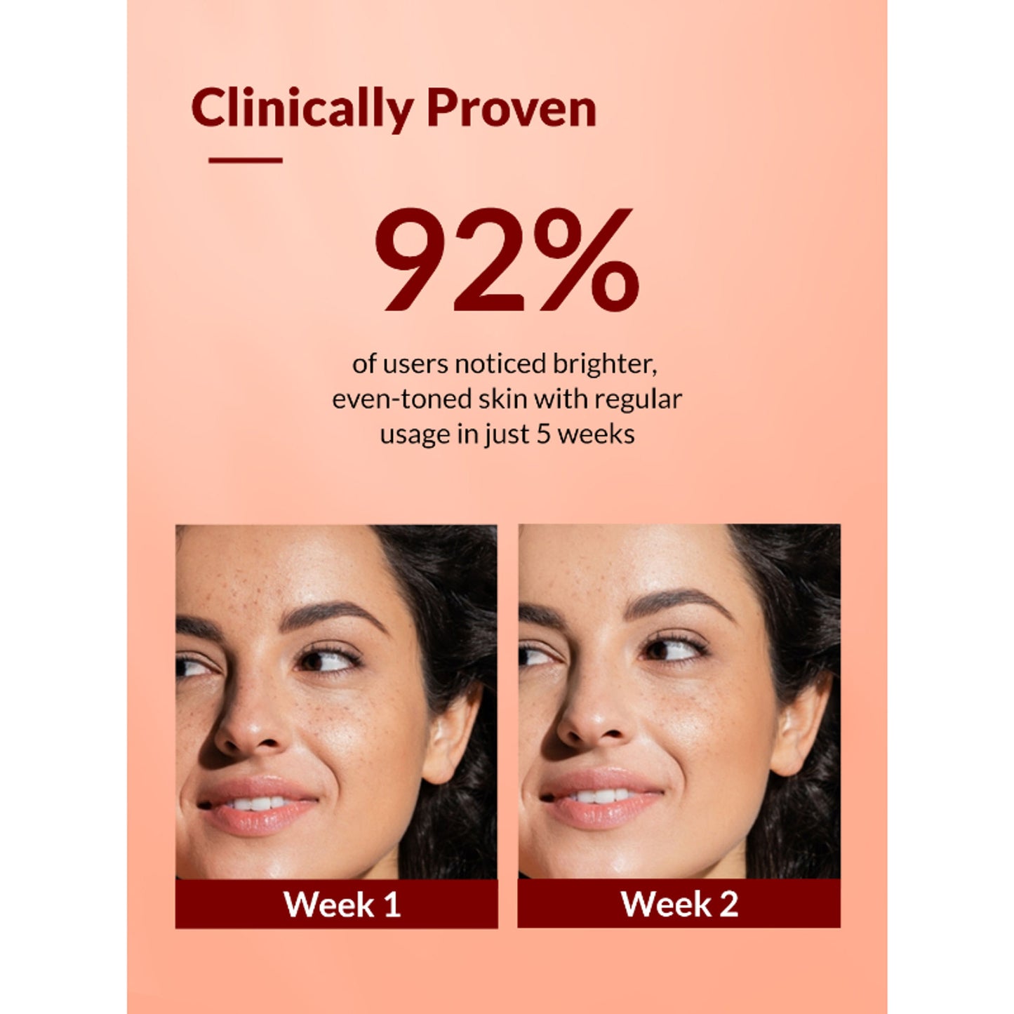 Fixderma Tranexamic Acid + 2%Kojic Acid + 1%Arbutin SKARFIX TX Face Cream For Pigmentation