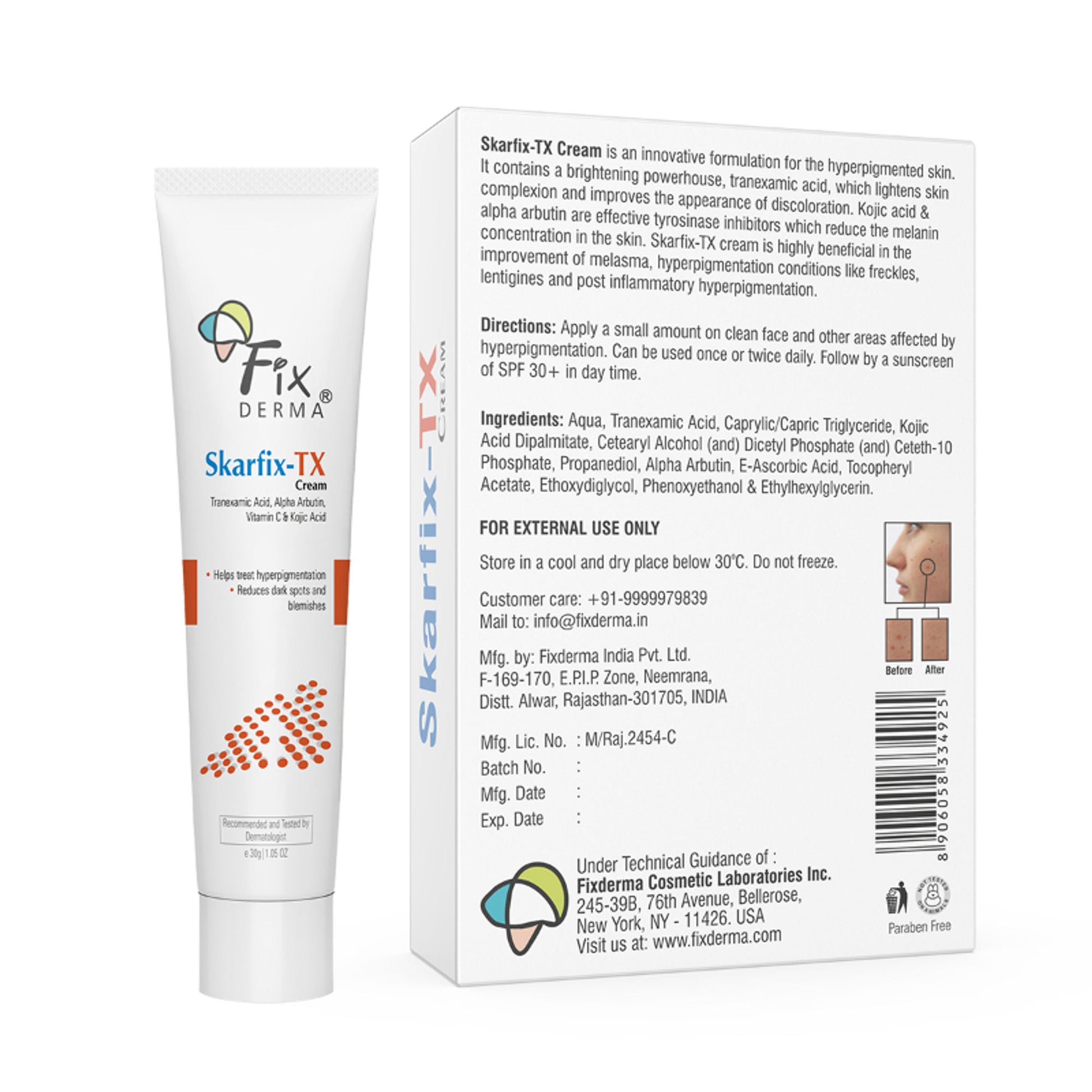 Fixderma Tranexamic Acid + 2%Kojic Acid + 1%Arbutin SKARFIX TX Face Cream For Pigmentation