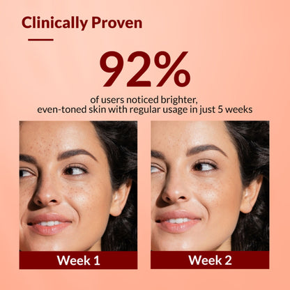 Fixderma Tranexamic Acid + 2%Kojic Acid + 1%Arbutin SKARFIX TX Face Cream For Pigmentation
