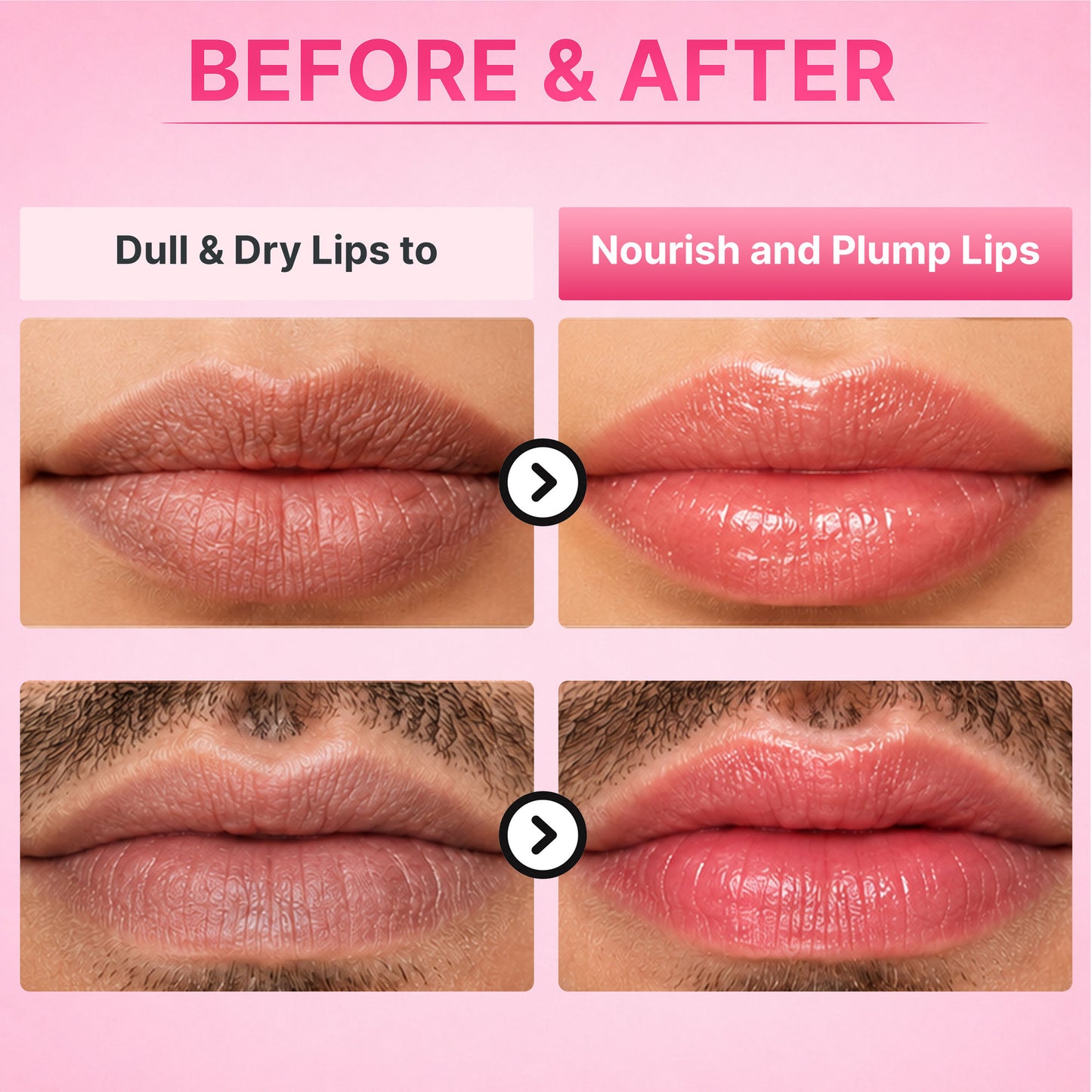 ALANNA Day Lip ButterMask, Moisturizing Daytime Lip Care, For Dark & Dry Pigmented Lips
