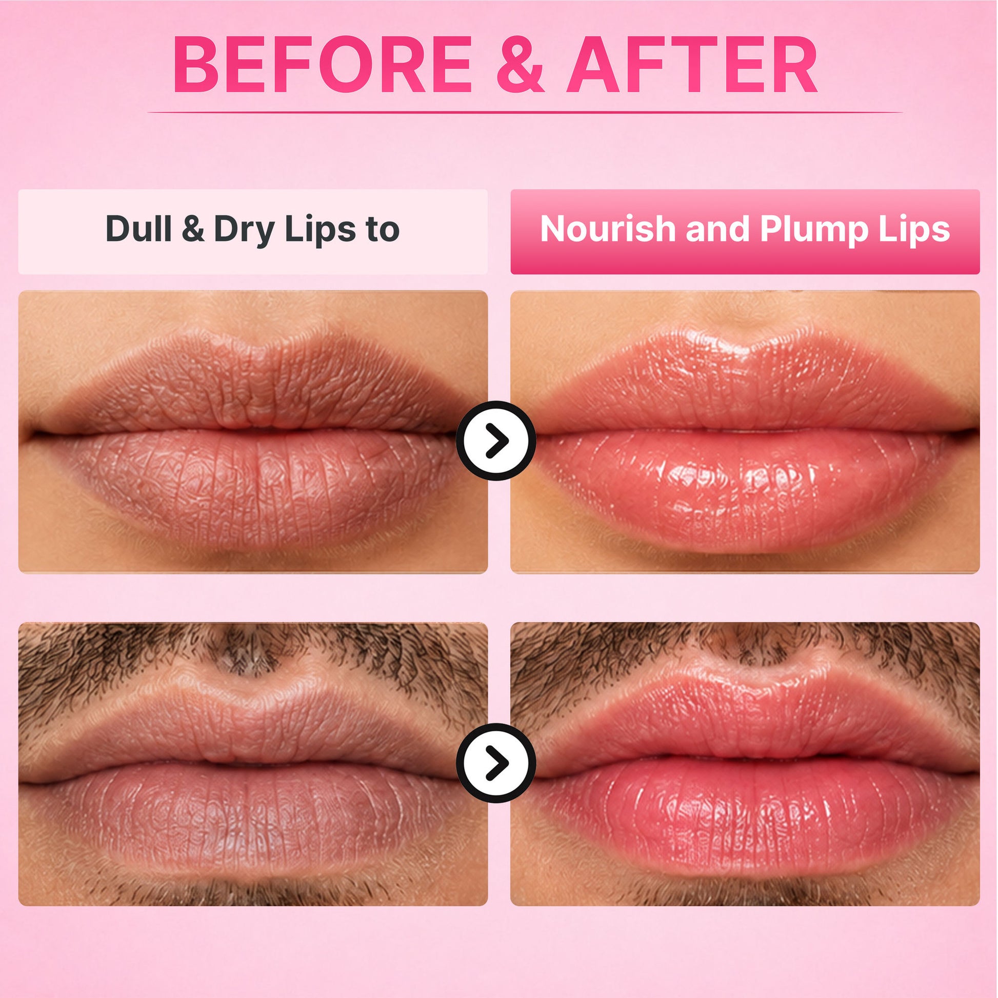 ALANNA Day Lip ButterMask, Moisturizing Daytime Lip Care, For Dark & Dry Pigmented Lips