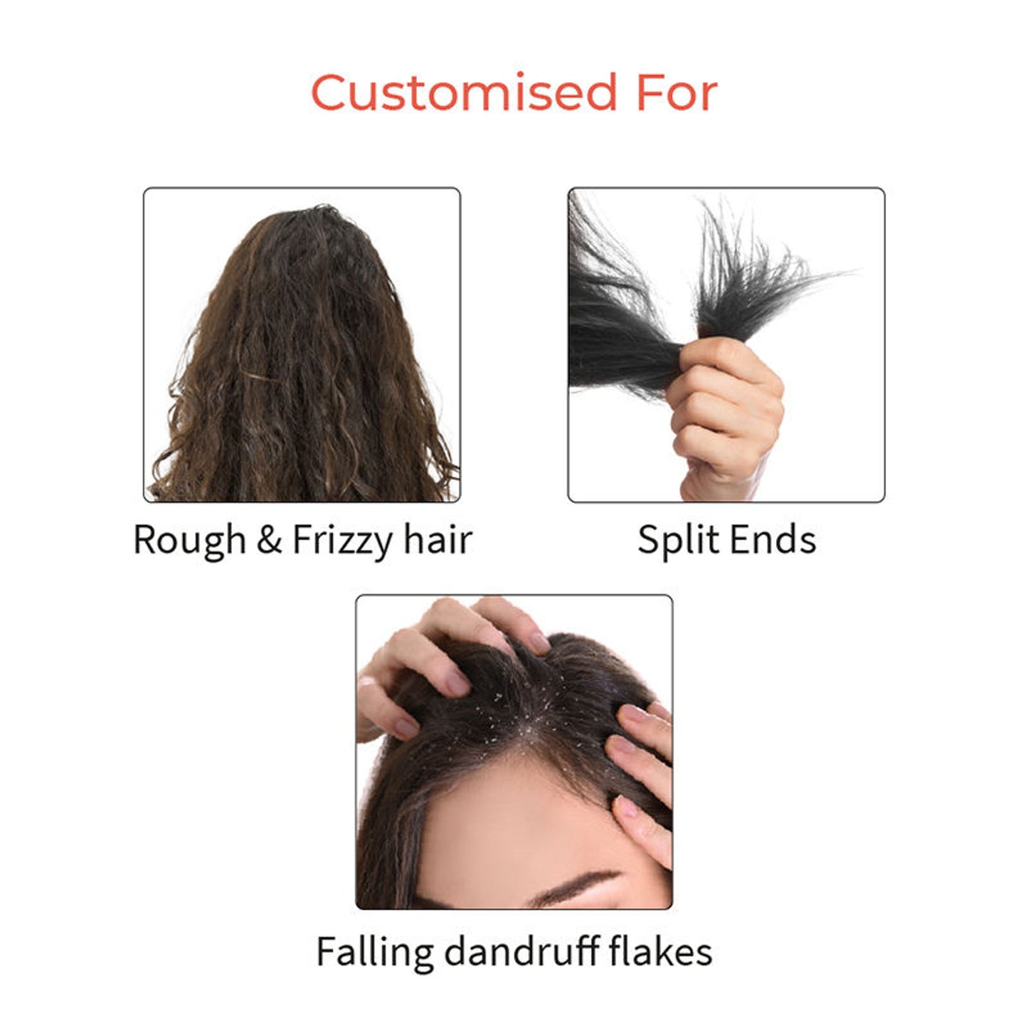 Vedix Dandruff Shampoo - Dry Hair - Vardara Deep Conditioning Dandruff Shampoo