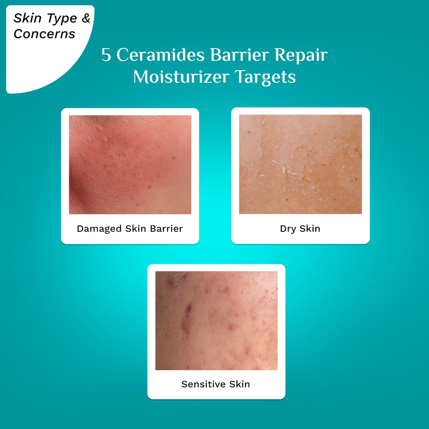 Pilgrim 5 Ceramides Barrier Repair Moisturizer with Korean CICA Lightweight & Non-Sticky