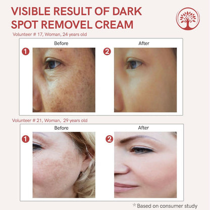 Ivory Natural dark spot removal face cream in a jar, showing smooth, glowing skin and the product packaging on a neutral background.