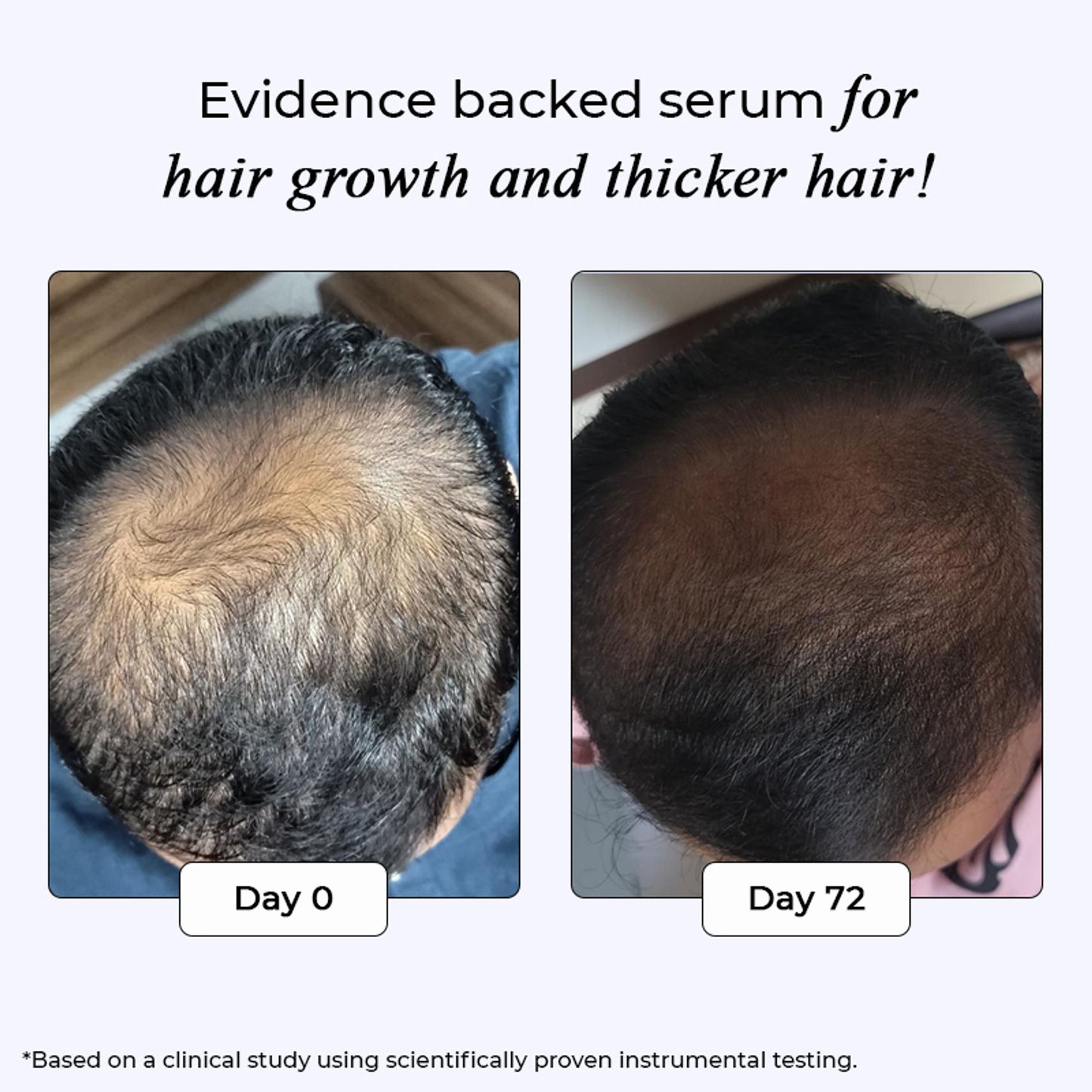 Dr. Su Revive Hair Growth Serum Hairfall Control, Improves Hair Density & Volume