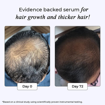 Dr. Su Revive Hair Growth Serum Hairfall Control, Improves Hair Density & Volume
