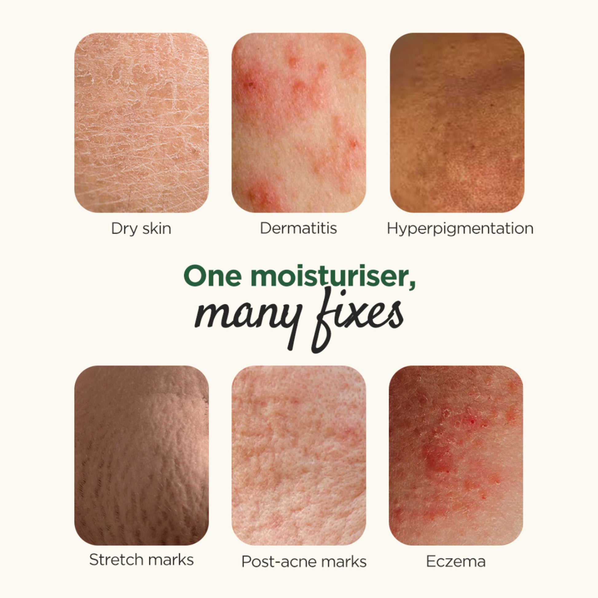 Elovera Moisturising Cream