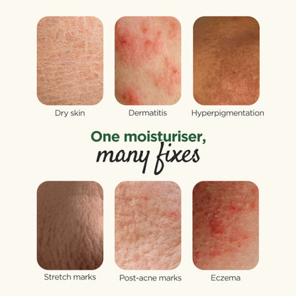 Elovera Moisturising Cream