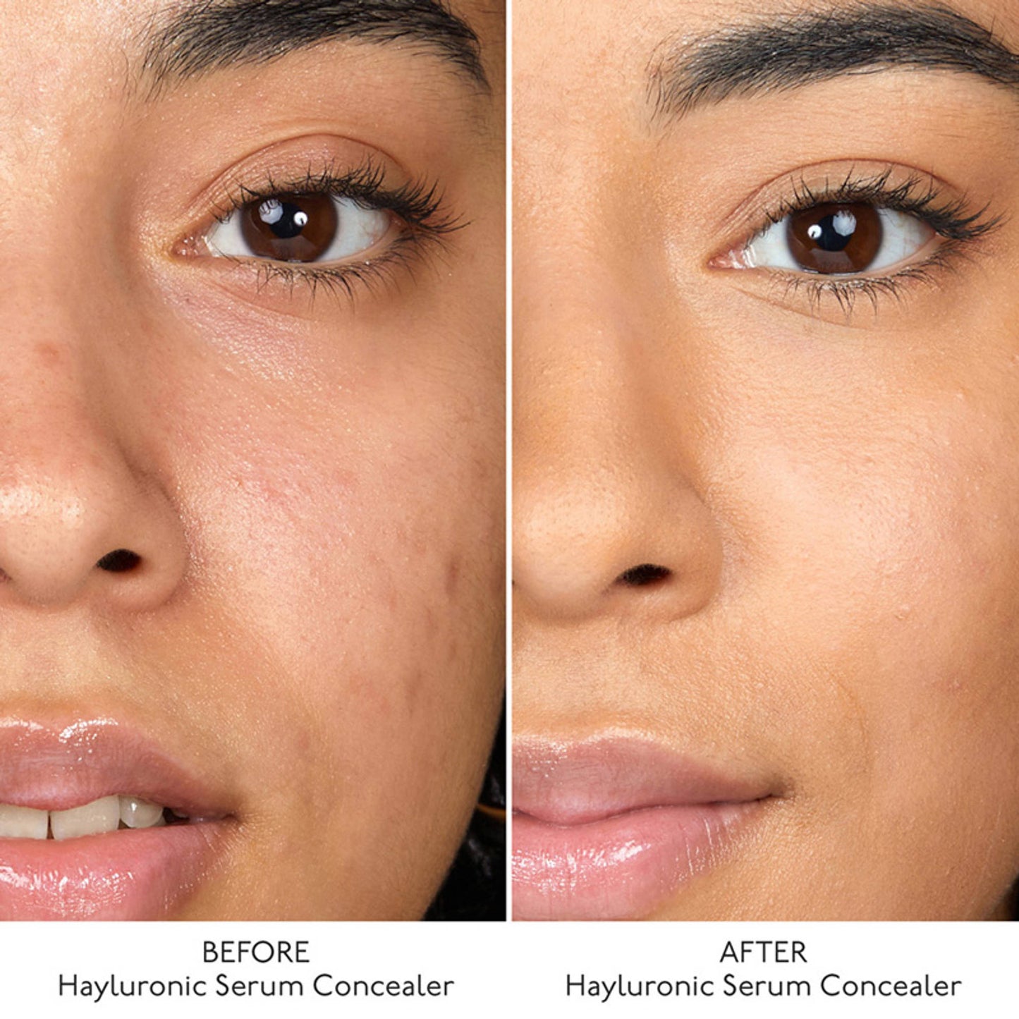 By Terry Hyaluronic Serum Concealer - 6. Peach Beige