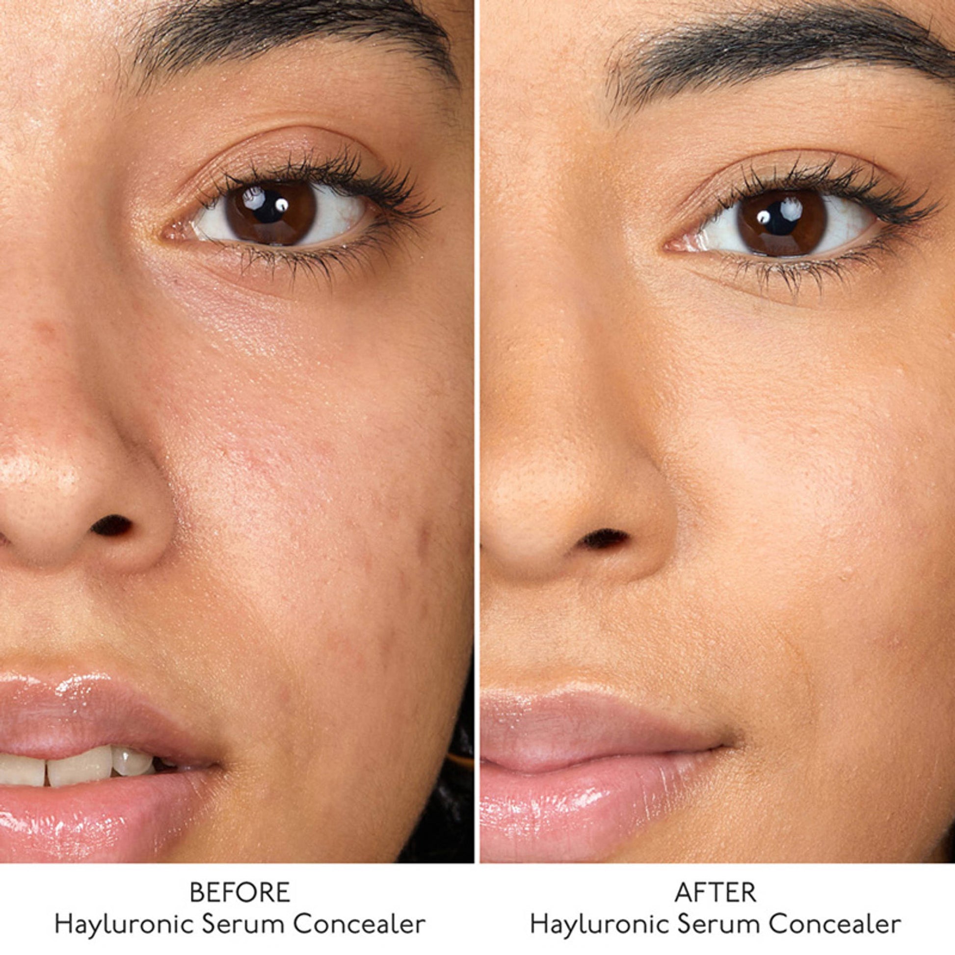 By Terry Hyaluronic Serum Concealer - 9. Amber Nude