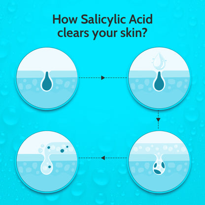 Chemist at Play 2% Salicylic Acid face serum in a pump bottle, designed to treat active acne and control excess oil.