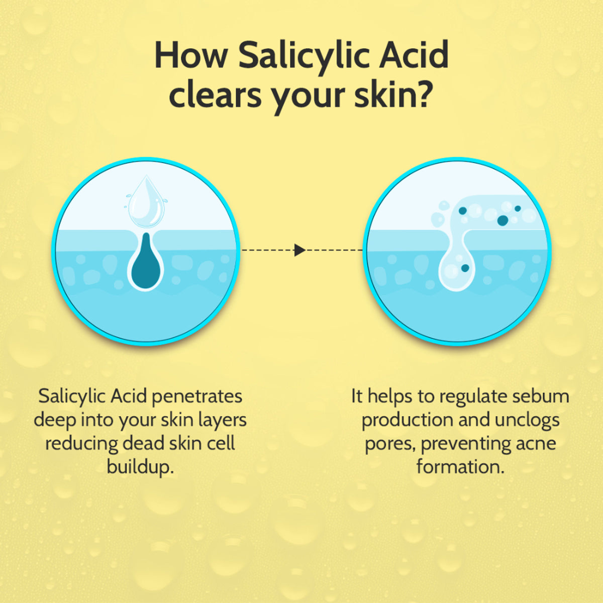 Chemist at Play 2% Salicylic Acid Face Serum for active acne and excess oil control, with dropper applicator on white background.
