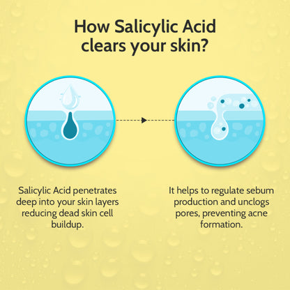 Chemist at Play 2% Salicylic Acid Face Serum for active acne and excess oil control, with dropper applicator on white background.