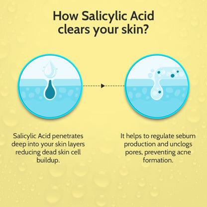 Chemist at Play 2% Salicylic Acid face serum in a dropper bottle, designed to treat active acne and control excess oil.