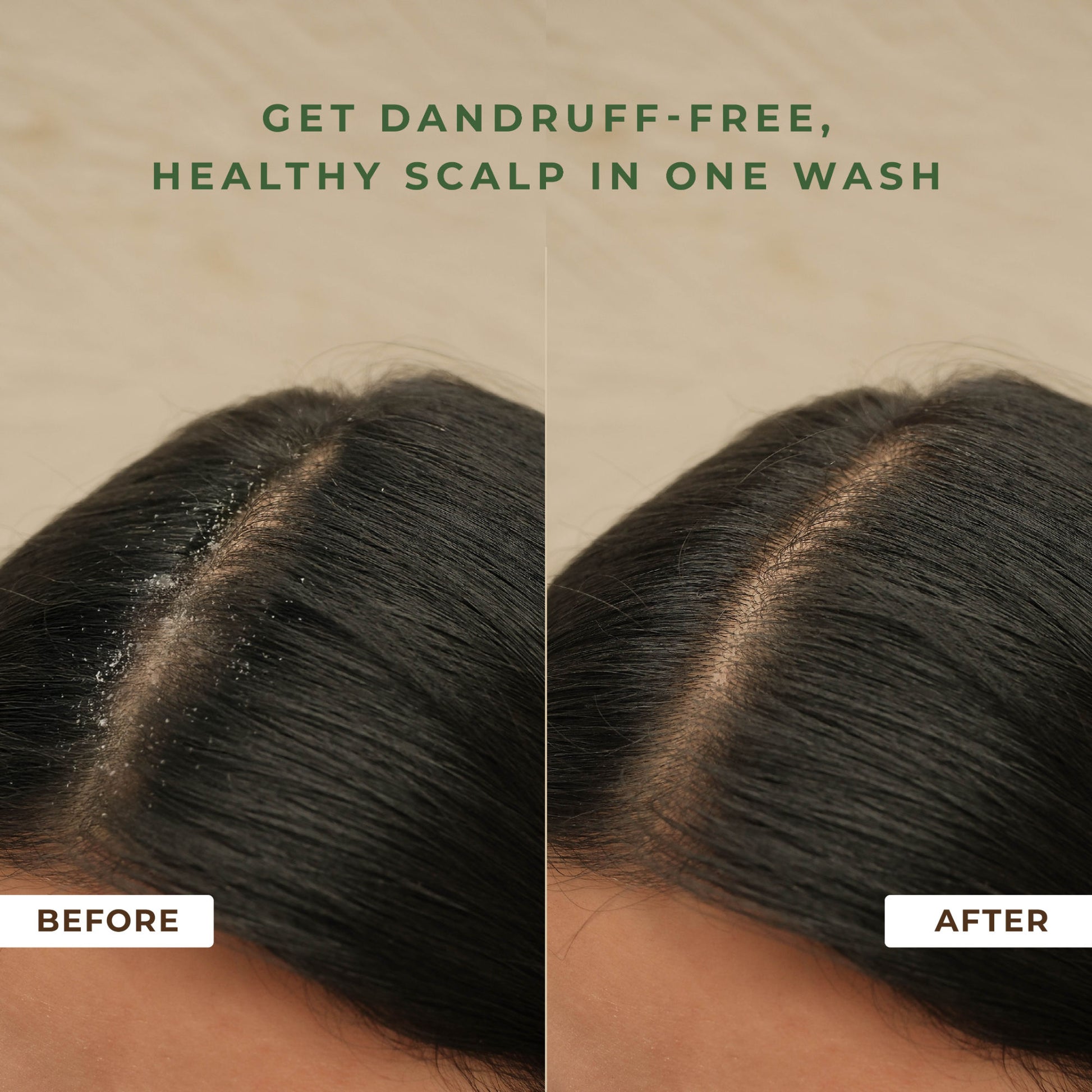 Naturali Anti Dandruff Shampoo With Hemp