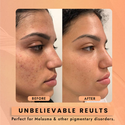 WILDGLOW 2% Kojic Acid Face Serum for Dark Spots, Skin Brightening & Radiant Glow