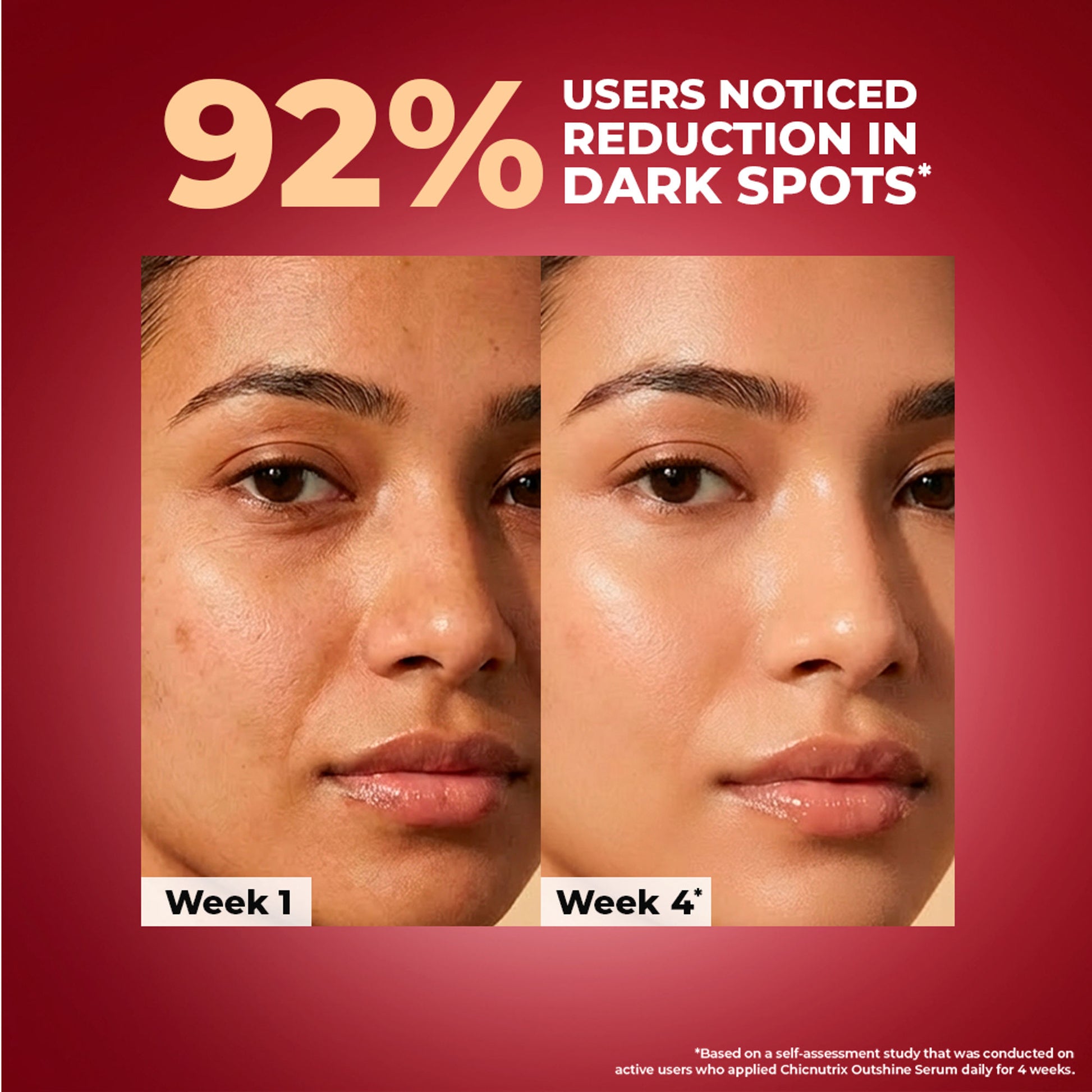 Outshine Korean Glass Skin Serum - Brightening & Dark Spot Corrector