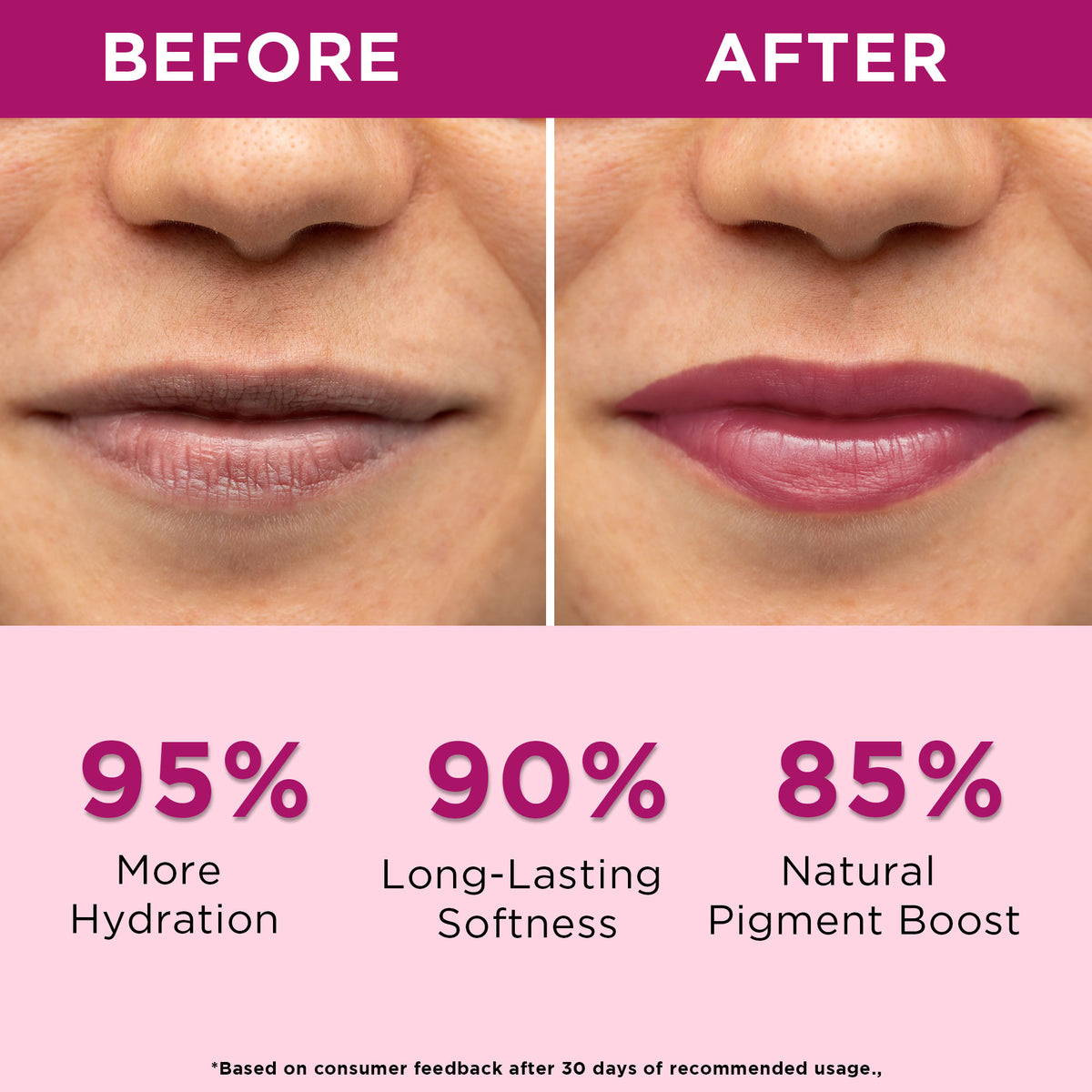 Orgatre Beetroot Tinted Lip Balm SPF 30 PA++ with Ceramide & Kojic Acid for Brighten Dark Lips