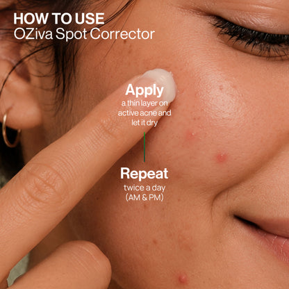 OZiva Acne Spot Corrector Reduces Pimples in 24 Hours, No Dryness & Salicylic Acid