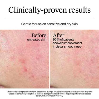Neutrogena Hydro Boost Nourishing Cream Moisturizer with Hyaluronic Acid + Ceramides For Dry Skin