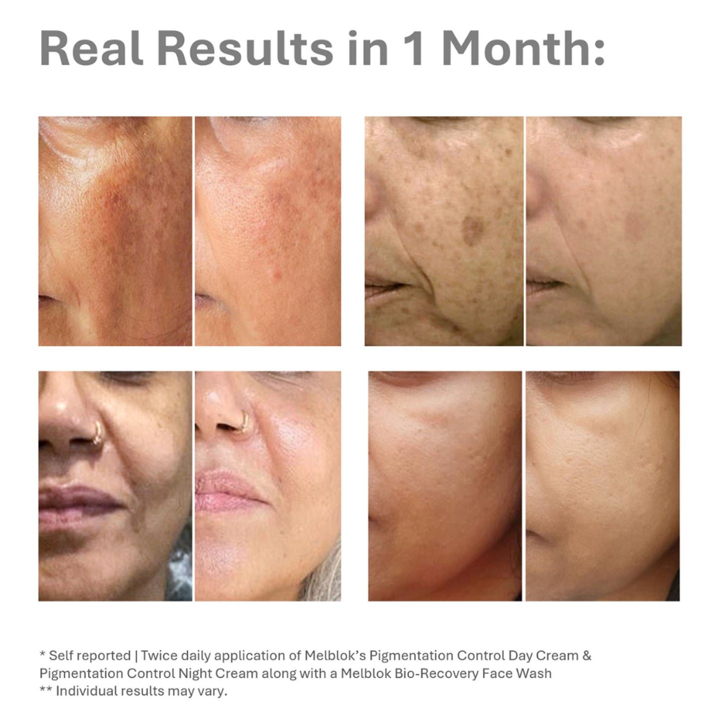 Melblok Pigmentation Control Day Cream - SPF 50+, PA++++