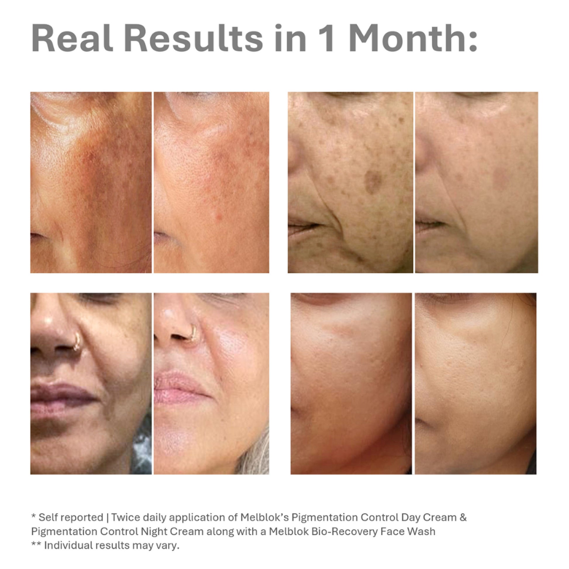 Melblok Pigmentation Control Day Cream - SPF 50+, PA++++