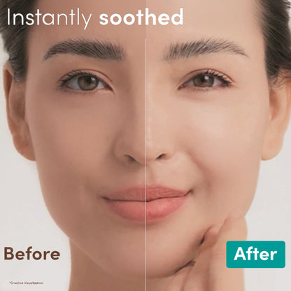 Aveeno Calm + Restore Hydrating Oat Face Serum Normal Dry Sensitive Skin Dermat Recommended