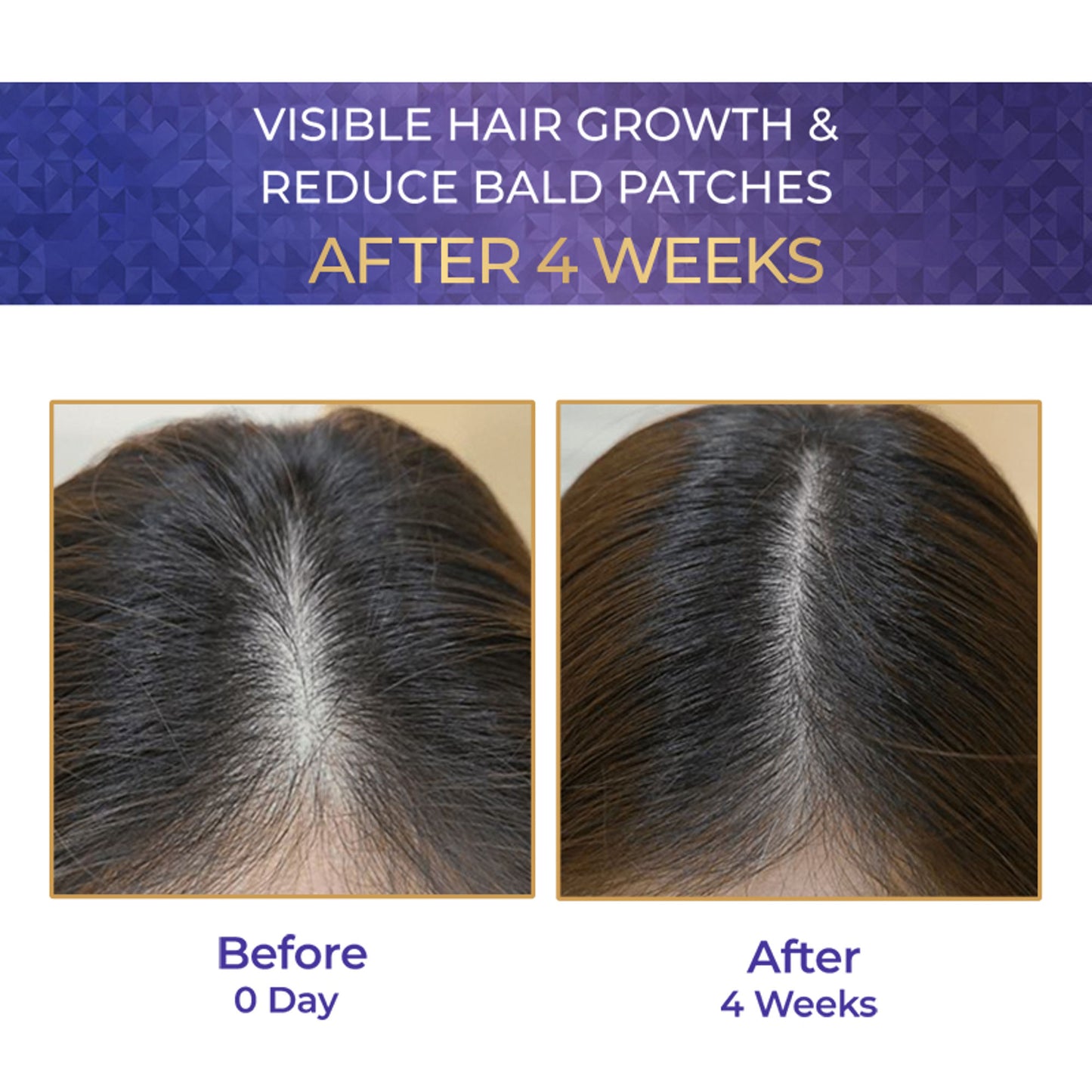 Streax Vitagrowth Hair Growth Serum with 3% Redensyl, 3% Anagain, 3% Baicapil, Biotin & Caffeine