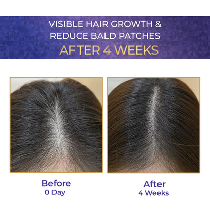 Streax Vitagrowth Hair Growth Serum with 3% Redensyl, 3% Anagain, 3% Baicapil, Biotin & Caffeine