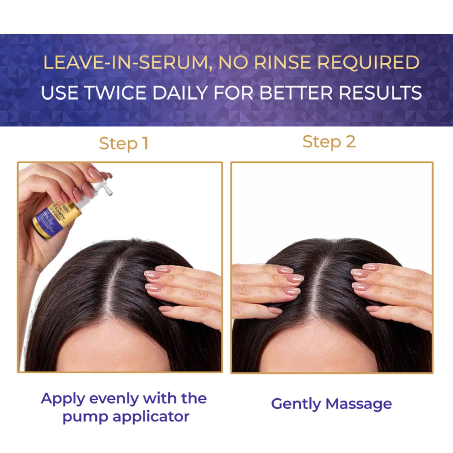 Streax Vitagrowth Hair Growth Serum with 3% Redensyl, 3% Anagain, 3% Baicapil, Biotin & Caffeine