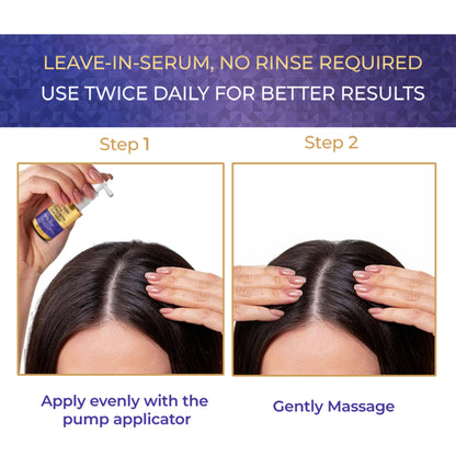 Streax Vitagrowth Hair Growth Serum with 3% Redensyl, 3% Anagain, 3% Baicapil, Biotin & Caffeine