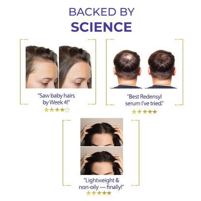 Streax Vitagrowth Hair Growth Serum with 3% Redensyl, 3% Anagain, 3% Baicapil, Biotin & Caffeine