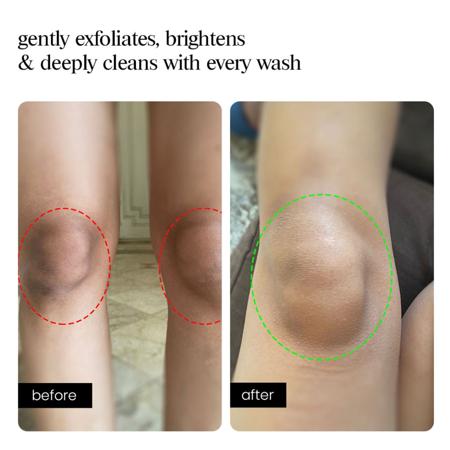 Aminu AHA Body Wash - Exfoliates Rough Texture & Keratosis Pilaris - Charcoal, Glycolic Acid, Mint