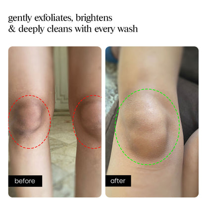 Aminu AHA Body Wash - Exfoliates Rough Texture & Keratosis Pilaris - Charcoal, Glycolic Acid, Mint