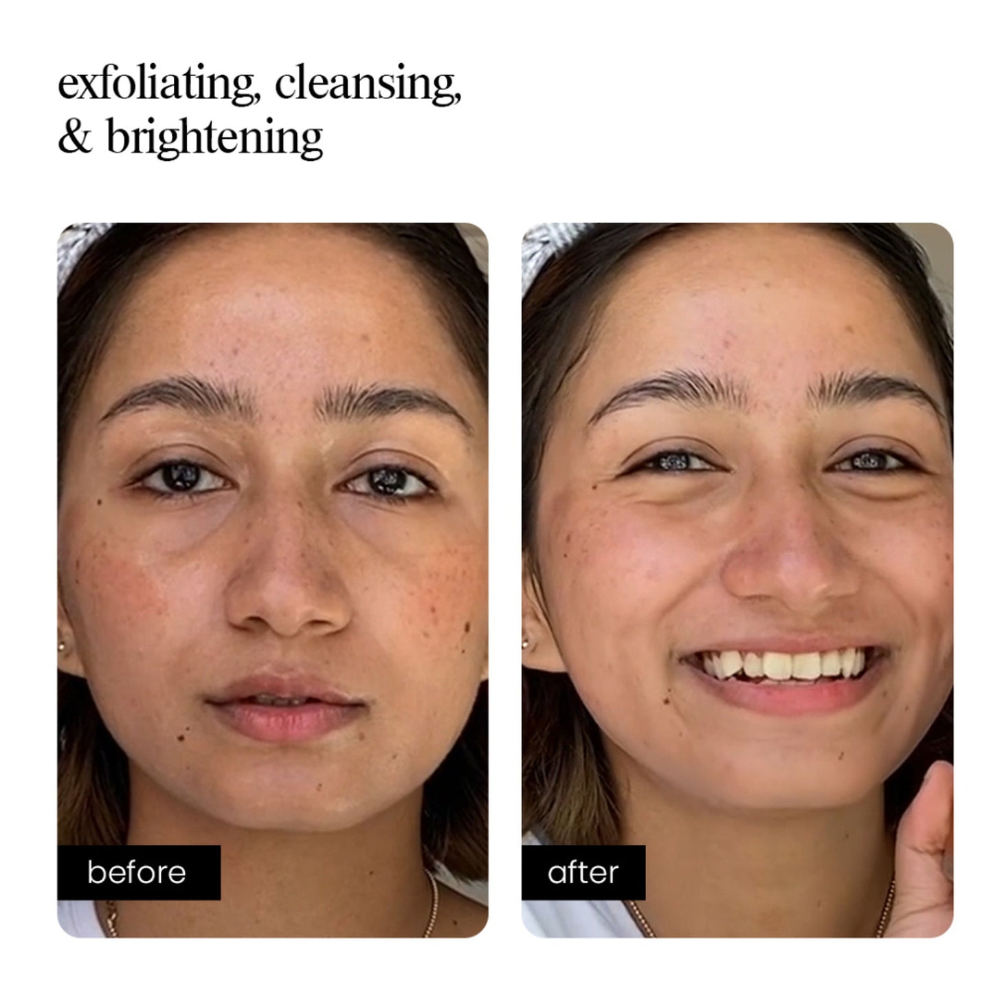 Aminu AHA Face Wash - Cleanser & Exfoliator for Acne, Dark Spots & Blemishes -Glycolic & Lactic Acid