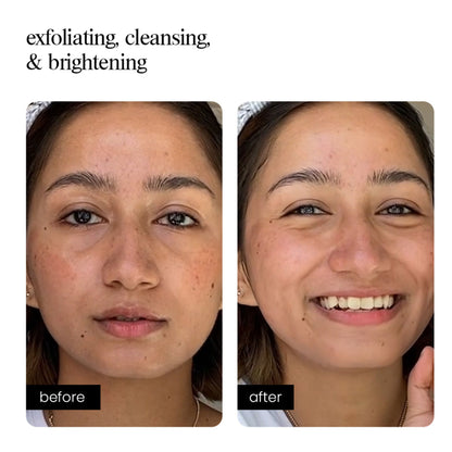 Aminu AHA Face Wash - Cleanser & Exfoliator for Acne, Dark Spots & Blemishes -Glycolic & Lactic Acid