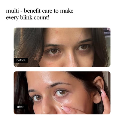 Aminu Eye Serum -Dark Circles, Puffiness, Wrinkles, Fine Lines -Caffeine, Ceramides, Peptide, Ectoin