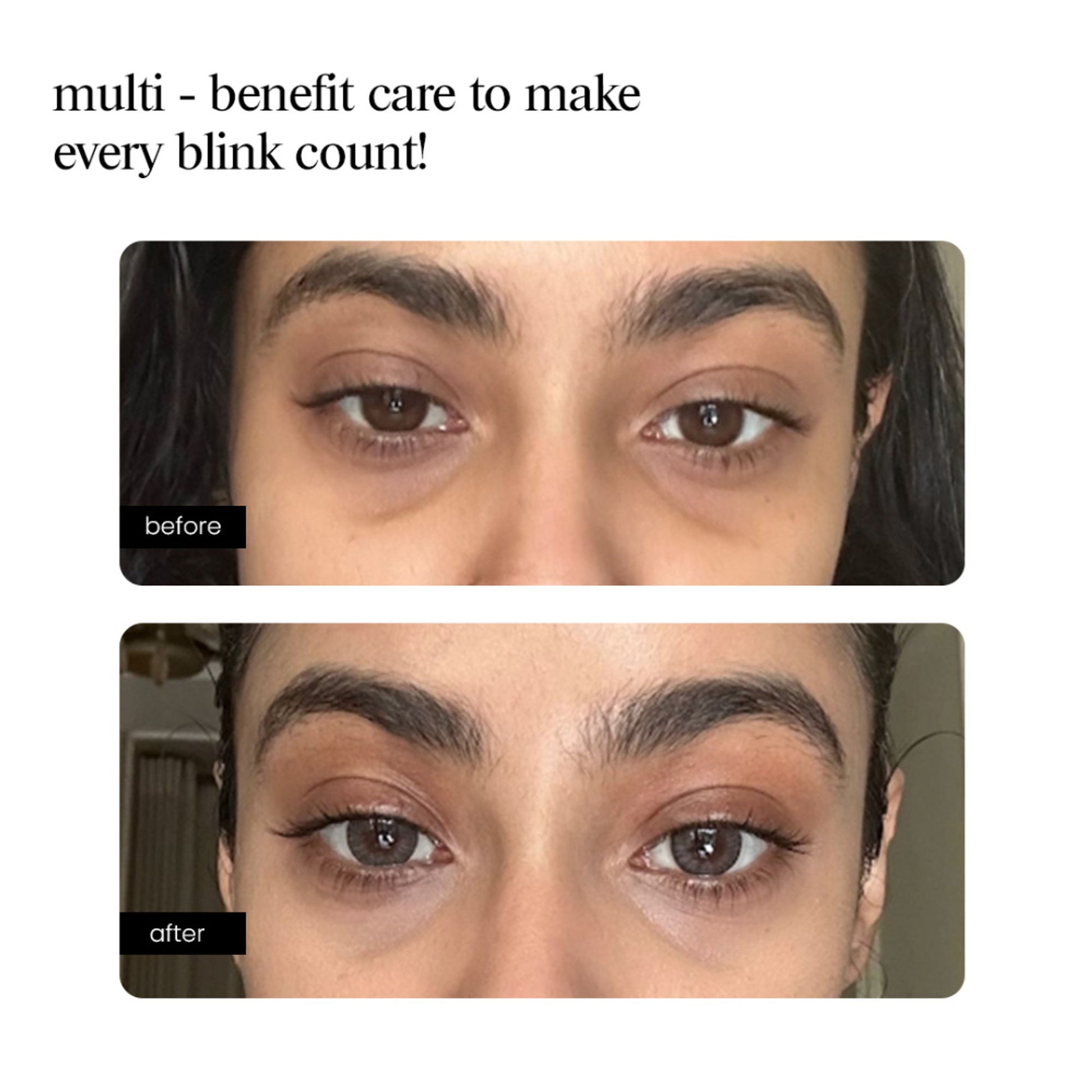 Aminu Eye Serum -Dark Circles, Puffiness, Wrinkles, Fine Lines -Caffeine, Ceramides, Peptide, Ectoin