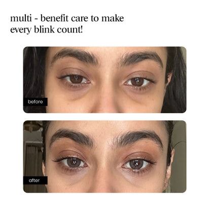 Aminu Eye Serum -Dark Circles, Puffiness, Wrinkles, Fine Lines -Caffeine, Ceramides, Peptide, Ectoin