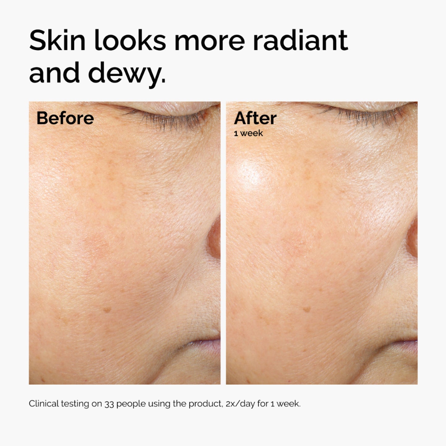 The Ordinary Rice Lipids + Ectoin Microemulsion - Light Weight Face Moisturizer