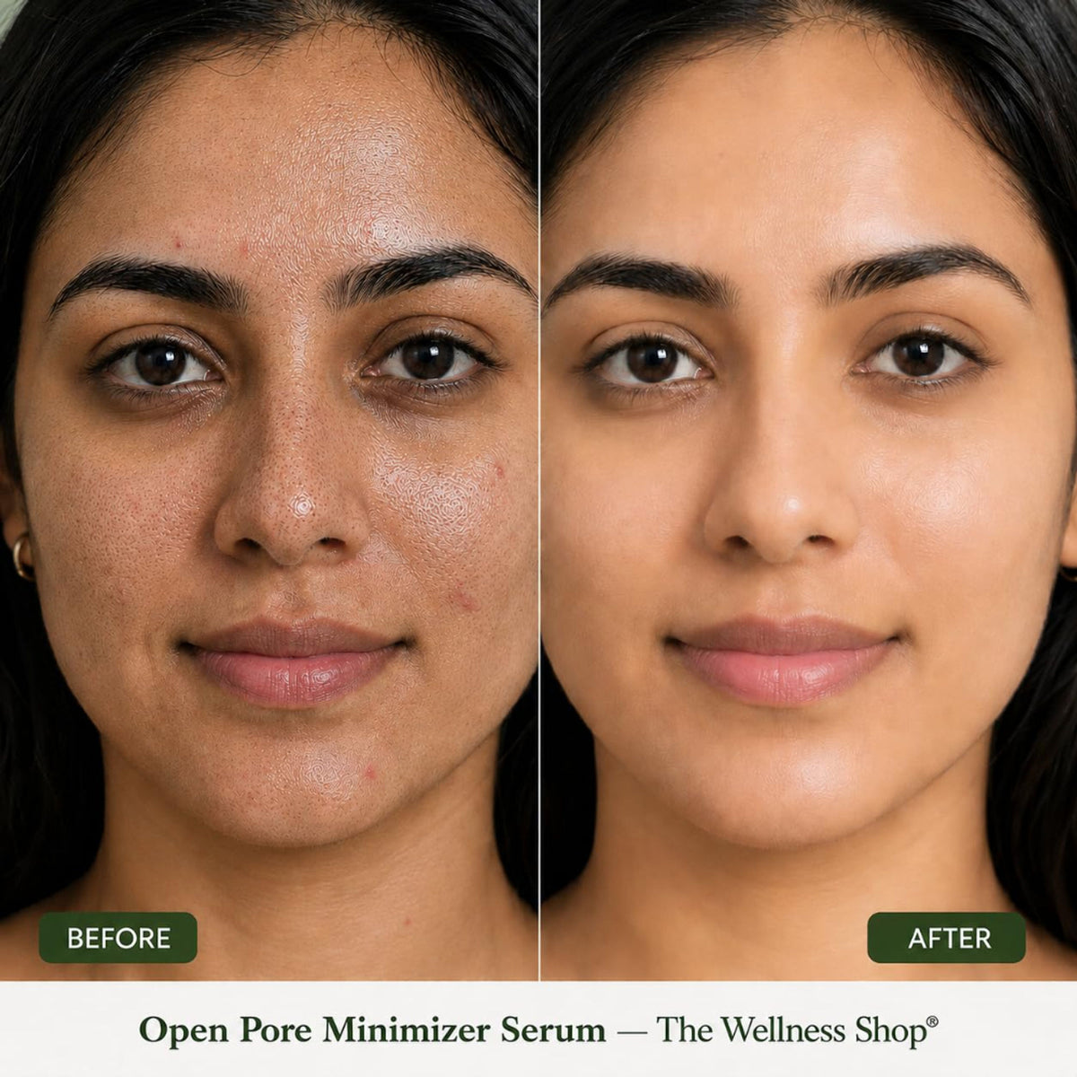 The Wellness Shop Open Pore Minimizer Face Serum for Oily & Acne Prone Skin, Reduce Dark Spot