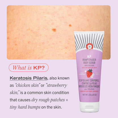 First Aid Beauty Strawberry KP Bump Eraser Body Scrub 10% AHA