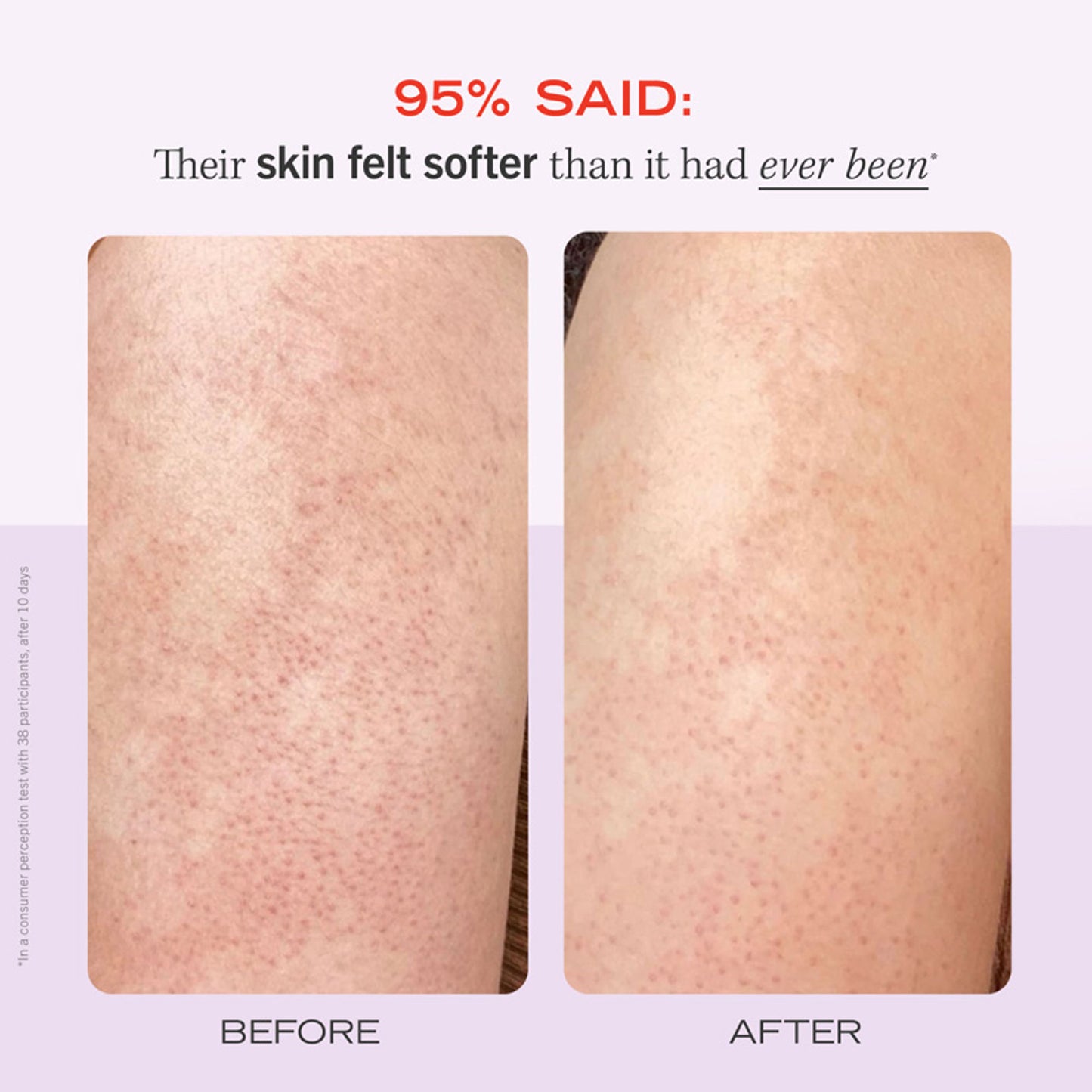 First Aid Beauty Strawberry KP Bump Eraser Body Scrub 10% AHA