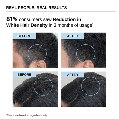 Bare Anatomy Advanced Anti-Grey Serum , Reduces Hair & Beard Greying, Non-Sticky, Odorless