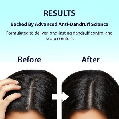 DERMISTRY Anti Dandruff Hair Serum Piroctone Climbazole Salicylic Acid For Flakes Dry Itchy Scalp