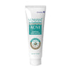 Venusia Acne Control Moisturizer| Oily Skin Friendly| Lightens Acne Scars|75g
