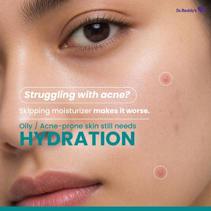 Venusia Acne Control Moisturizer| Oily Skin Friendly| Lightens Acne Scars|75g