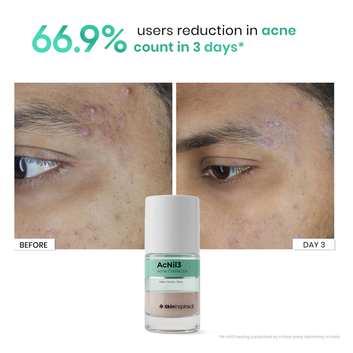 SkinInspired Acnil3 Rapid Spot Corrector