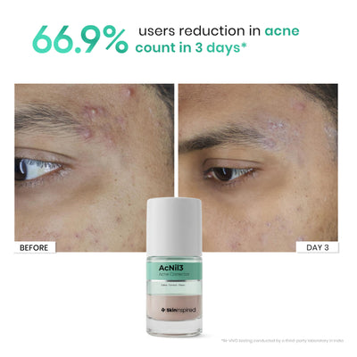 SkinInspired Acnil3 Rapid Spot Corrector