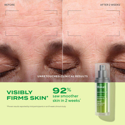 Murad Retinol Youth Renewal Serum
